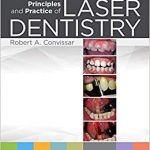 Principles and practice of laser dentistry