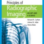 Principles of radiographic imaging : an art and a science
