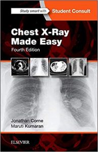 Chest X-ray made easy